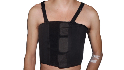 Post-operative thoracic jacket for Pectus treatment Post-operative thoracic jacket for Pectus treatment