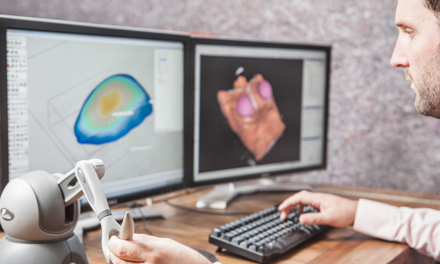 Our expertise in 3D implant modeling AnatomikModeling expert working on a 3D implant model