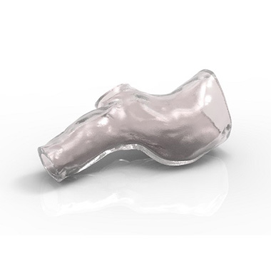 Il primo stent 3D personalizzato per le vie aeree del mondo