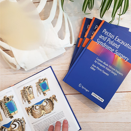 Springer book release: Pectus Excavatum and Poland Syndrome Surgery