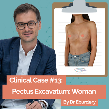 Clinical case by Dr Eburdery : woman's breast asymmetry