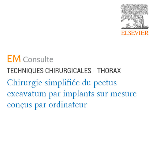 Chirurgie simplifiée du pectus par implants sur mesure (CAO)