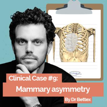 Pectus clinical case by Dr Bettex