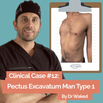 Clinical case #12: asymmetrical pectus by Dr Waked