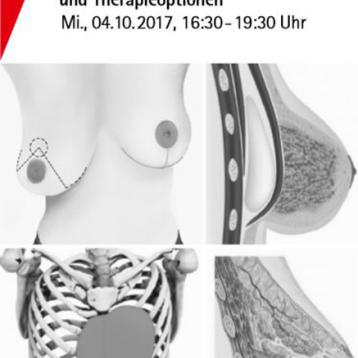Symposium “Congenital malformation of the breast and chest wall”, 4th of October 2017, Bonn, Germany