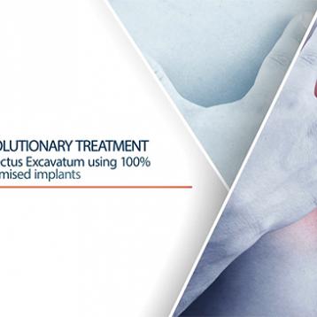 Pectus Excavatum treatment using 3D custom-made implants Video
